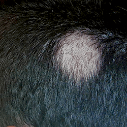 Studio Sorbellini Alopecia Areata in chiazze-prima