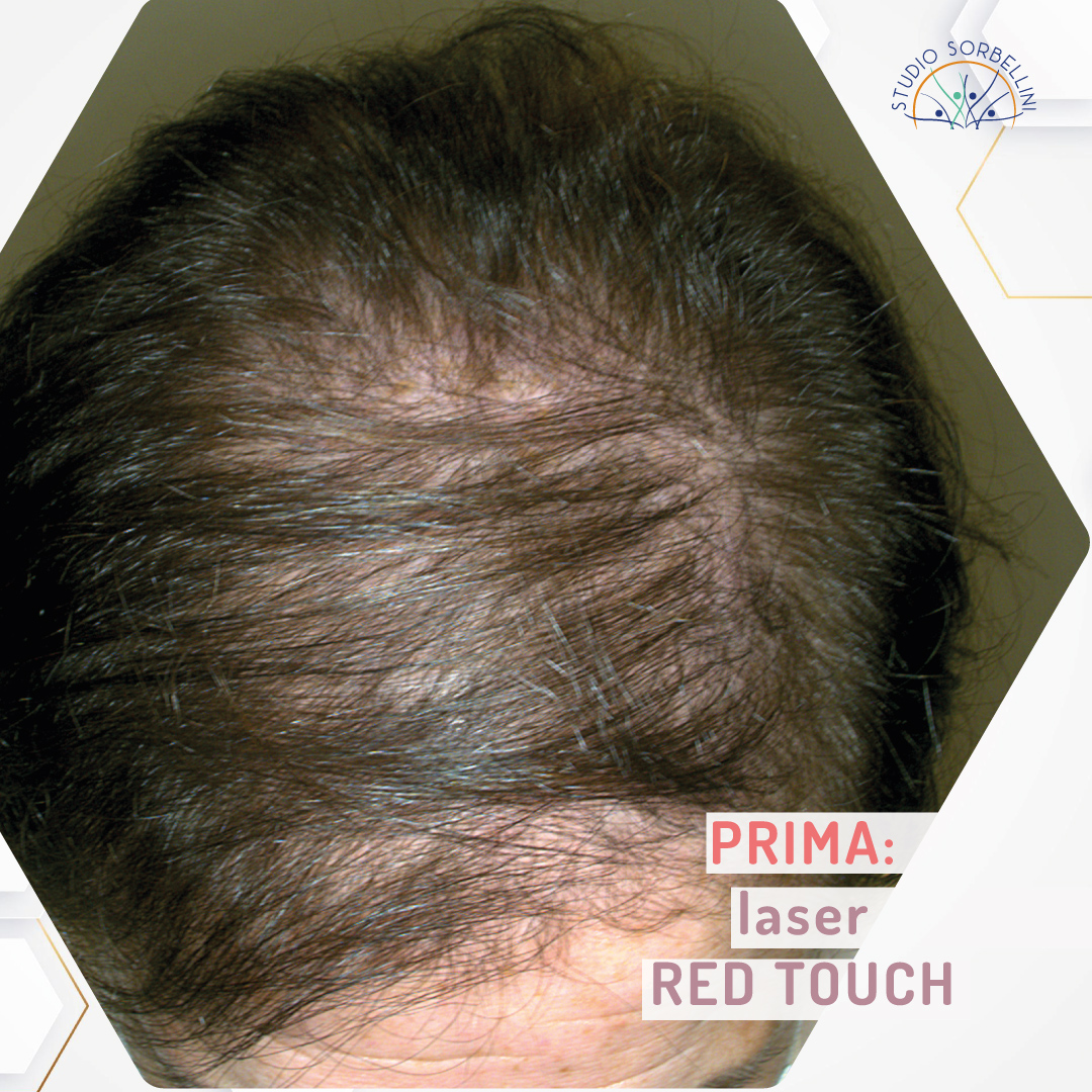 RedTouch-1-prima-big